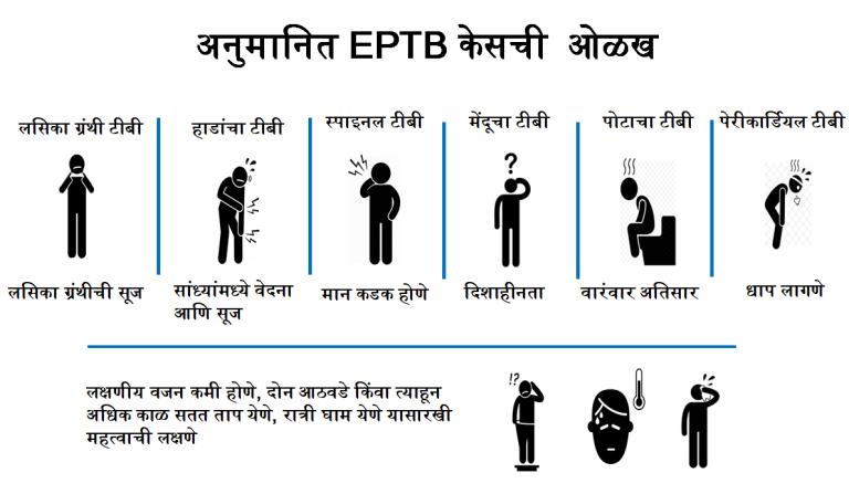 एक्स्ट्रा पल्मोनरी टीबीची साइट्स