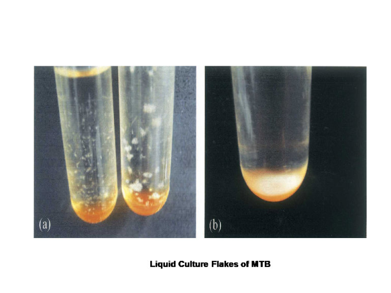 Liquid Flakes of MTB