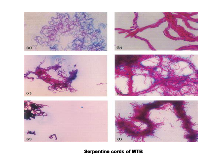 Serpentine cords of MTB