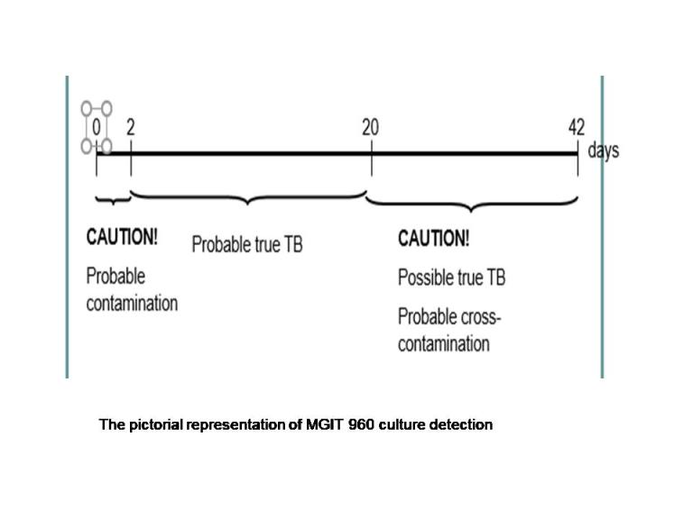 The pictorial representation of MGIT 960 culture detection